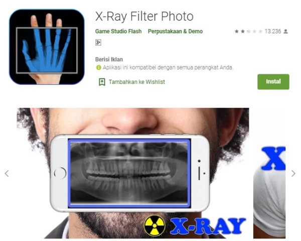 Aplikasi foto x-ray